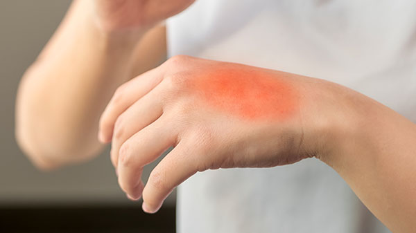 Treatment of Skin Diseases in the Spa Town of Mariánské Lázně